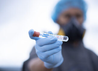 Coronavirus: in Toscana 147 nuovi casi, 1 decesso, 48 guarigioni