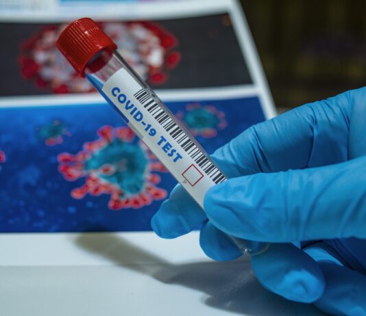 Coronavirus: 10 nuovi casi in provincia di Arezzo