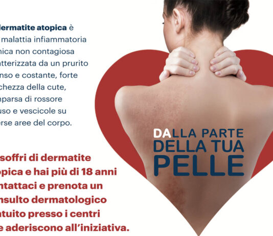 Dermatite atopica dell’adulto: il 26 settembre consulti dermatologici gratuiti ad arezzo