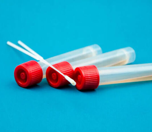 Covid-19: Il tampone, ecco come farlo e come conoscere la risposta