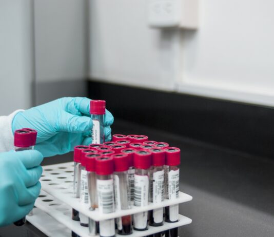 Coronavirus: 114 nuovi casi nell’aretino, 115 in degenza covid, 30 in terapia intensiva, 105 persone guarite, 1 decesso