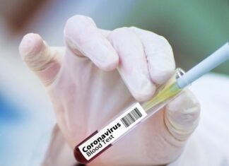 Coronavirus: 36 nuovi casi nell’aretino, 58 in degenza covid, 14 in terapia intensiva, 16 guariti, 0 decessi