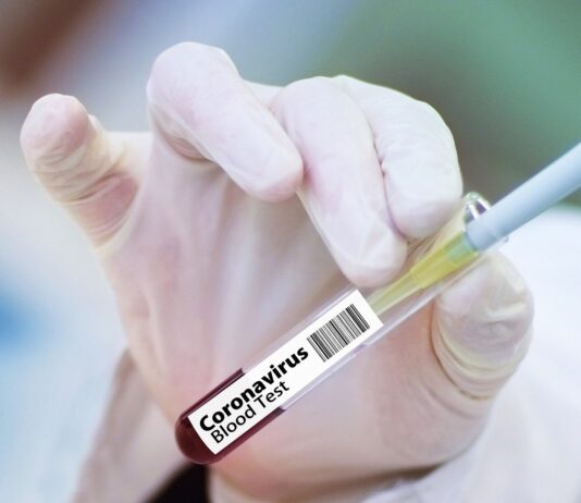 Coronavirus: 36 nuovi casi nell’aretino, 58 in degenza covid, 14 in terapia intensiva, 16 guariti, 0 decessi