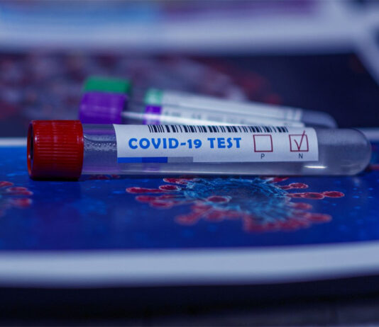 Coronavirus, in Toscana 498 nuovi casi, 20 decessi