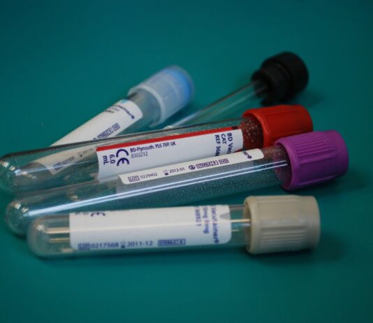 Coronavirus: 44 nuovi casi positivi nell’aretino, 72 in degenza covid, 17 in degenza covid, 7 persone guariti, 0 decessi