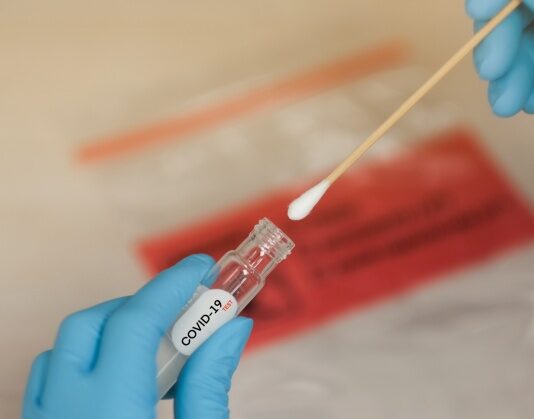 Coronavirus: in Toscana 521 nuovi casi. Tre i decessi con un’età media di 82,3 anni