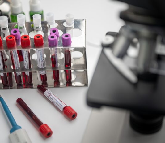 Coronavirus: 53 nuovi casi nell’aretino, 8 persone in degenza covid