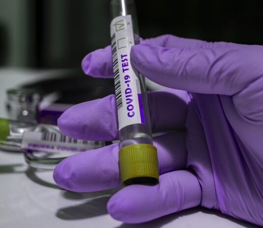 Coronavirus: 502 nuovi casi nell’aretino, 44 persone in degenza covid, 6 in terapia intensiva