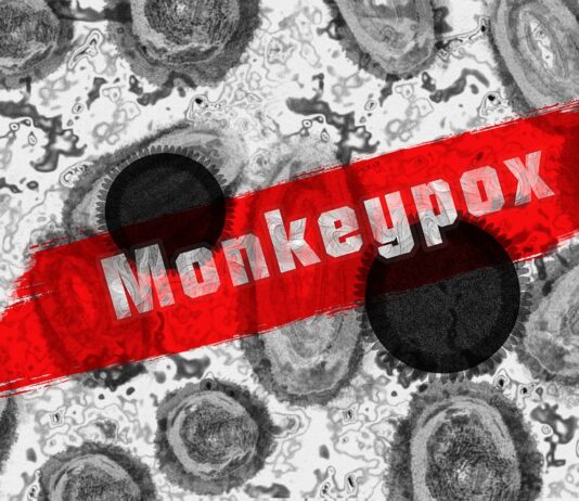 14 settembre 2022: iniziano le vaccinazioni con Jynneos ad Arezzo