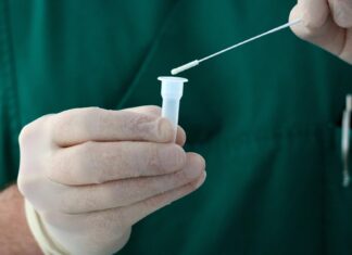 Coronavirus: in Toscana 156 nuovi casi e 5 decessi, di 73,8 anni d’età media