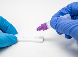 Coronavirus: in Toscana 246 nuovi casi. Deceduta una donna di 87 anni